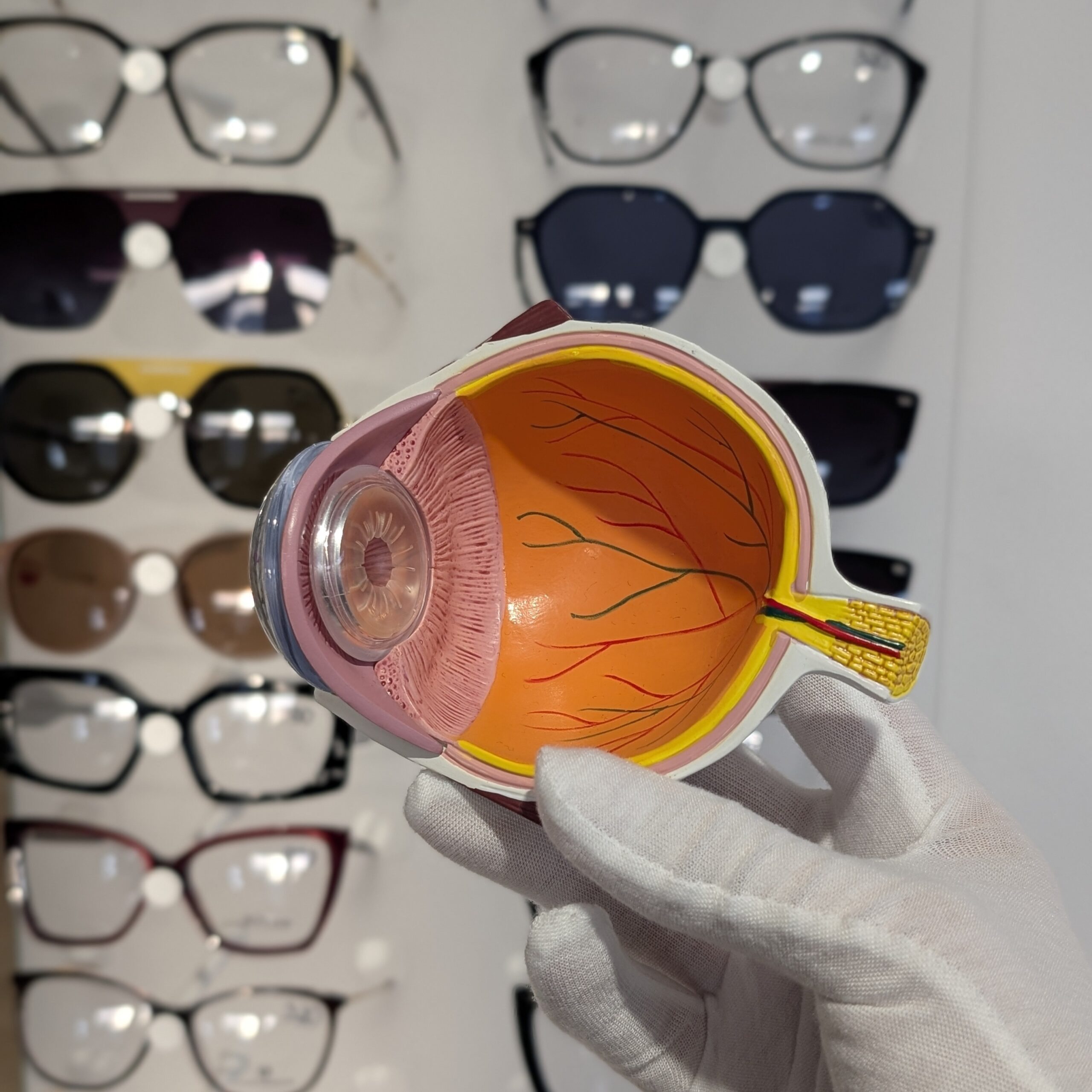 Fascynująca Podróż przez Starzejące się Oko