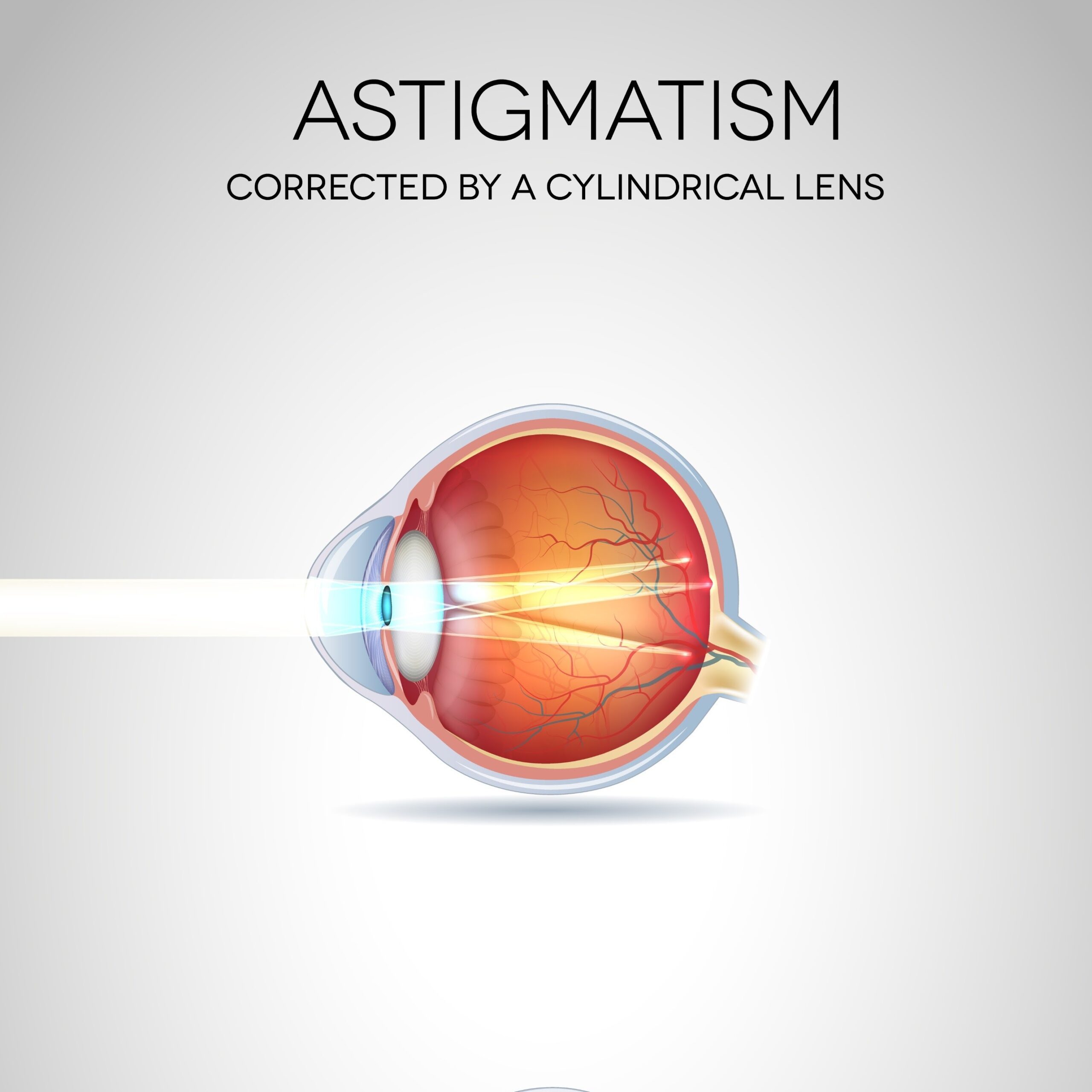 Jak okulary i soczewki korygują astygmatyzm?